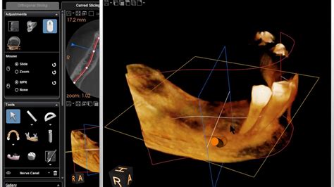 CS 3D Imaging Software .